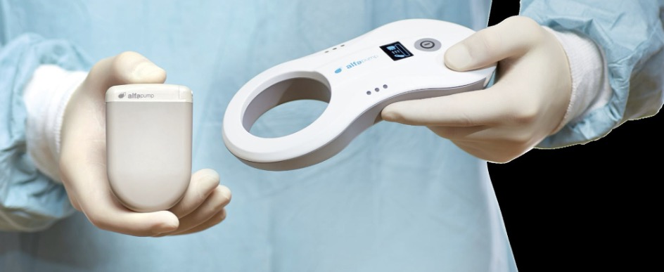 Sequana Medical